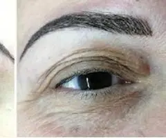 Puder obrve Zarkovo - 2